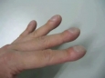 【医问到底】哪些关节疼痛不是关节老化引起的？