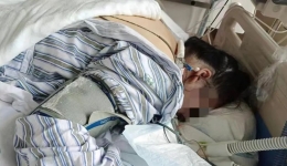 患者命悬一线，ICU力挽狂澜——我院西院重症医学科成功抢救一例重度ARDS患者