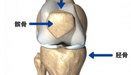 工医科普 | 年轻人不可忽略的膝关节损伤——髌骨脱位
