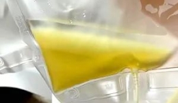 工医科普 | 血液里洗出黄“油”，原来是被你忽视的高脂血症