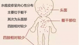 注意！这些病进入多发期，有的发病很急！