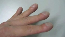 【医问到底】哪些关节疼痛不是关节老化引起的？