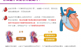 知心声 强心力——柳州市工人医院心衰中心教你如何防治心衰