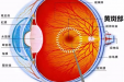 工医科普 | 眼睛内有“破洞”？竟是黄斑裂孔惹的祸