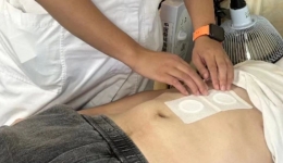 趁“热”打“贴”——中医骨科“三伏贴”安排上