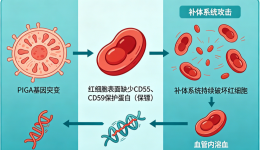 关注罕见病㉑ | 阵发性睡眠性血红蛋白症——神秘的“酱油尿”