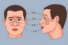 慢病科普知识系列㉑  | 鼻塞流涕总不好？别再当感冒治了！