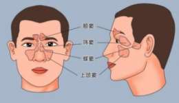 慢病科普知识系列㉑  | 鼻塞流涕总不好？别再当感冒治了！