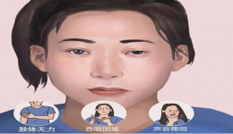 关注罕见病㉒  | 一种有望临床“治愈”的罕见病——重症肌无力